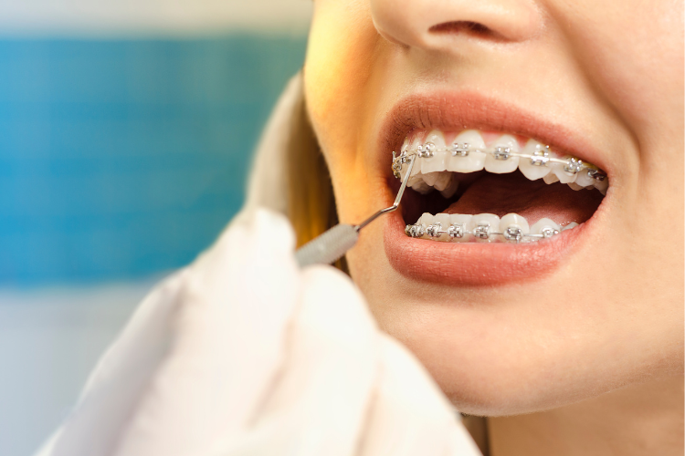 tratamento-ortodontia-pagina